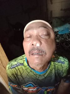 Nandang, Petani Sumedang, Butuh Bantuan Pengobatan Kanker Rahang